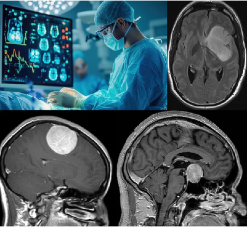 Neurosurgical Diagnosis